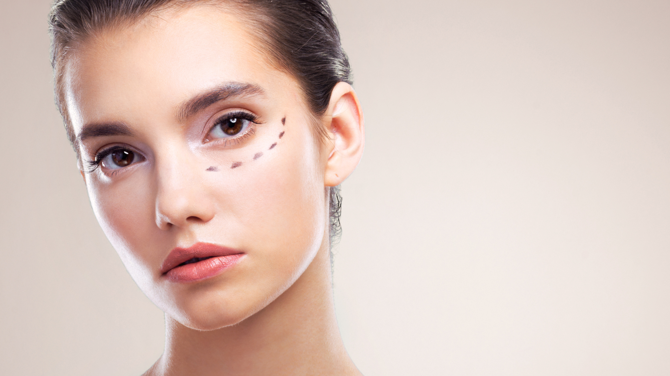 Endolift Under Eyes: A Safe Alternative to Surgery