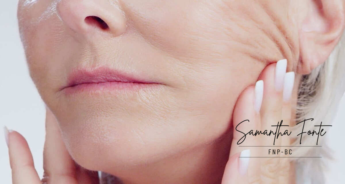 "Ozempic Face" in Miami: The Non-Surgical Protocol to Tighten Loose Skin