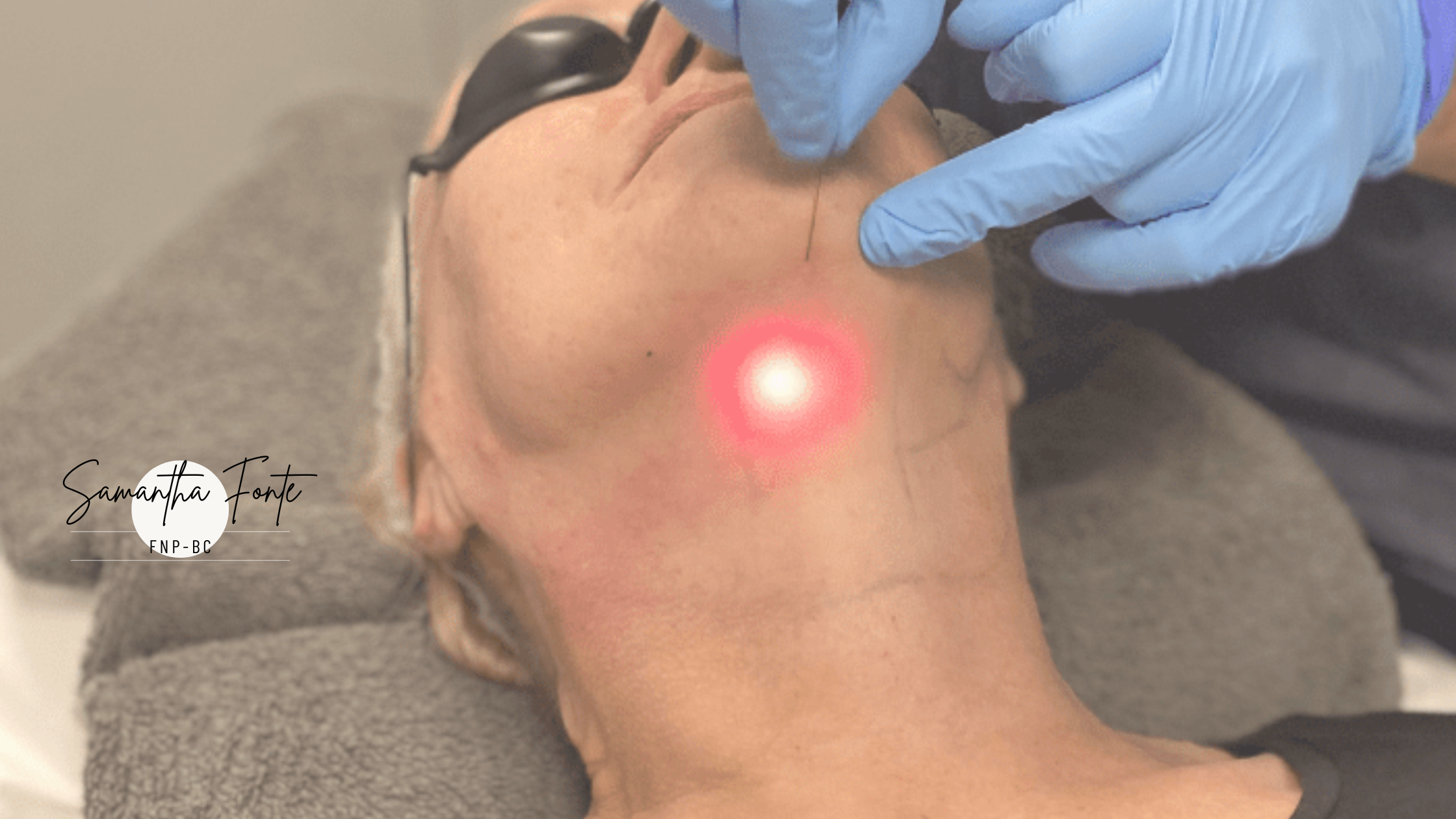 Endolift Cost in Miami (2026): Prices by Area at My Nuceria