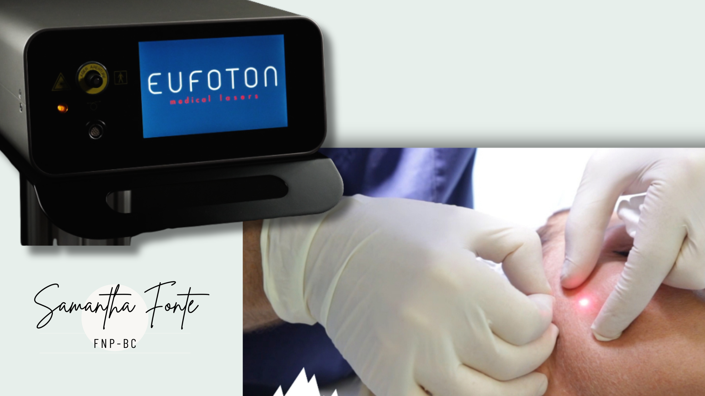 Endolift Machine: Benefits, Procedure, Reviews & Price