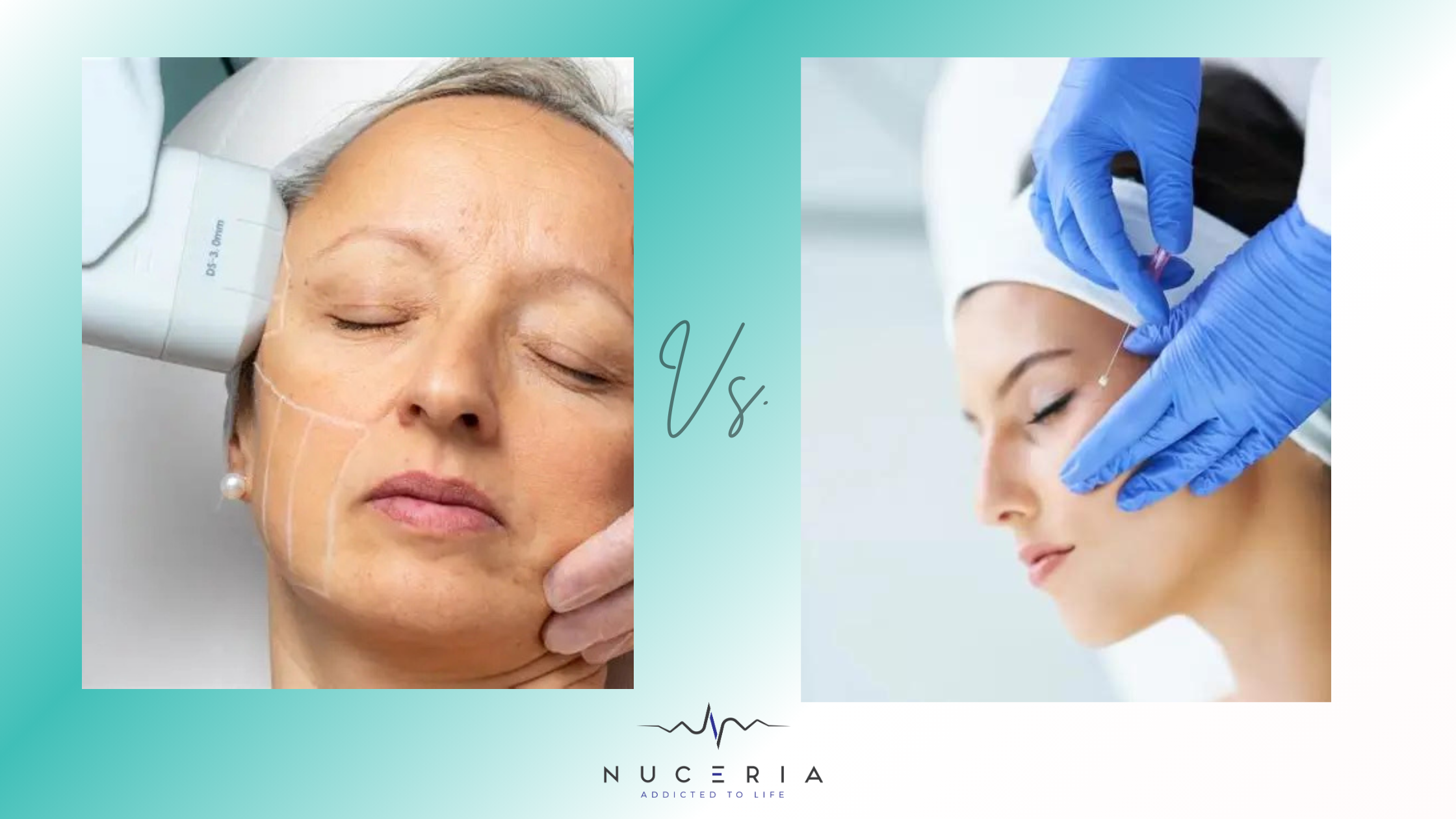 Endolift vs HIFU: Which Skin Tightening Treatment Is Better for You?