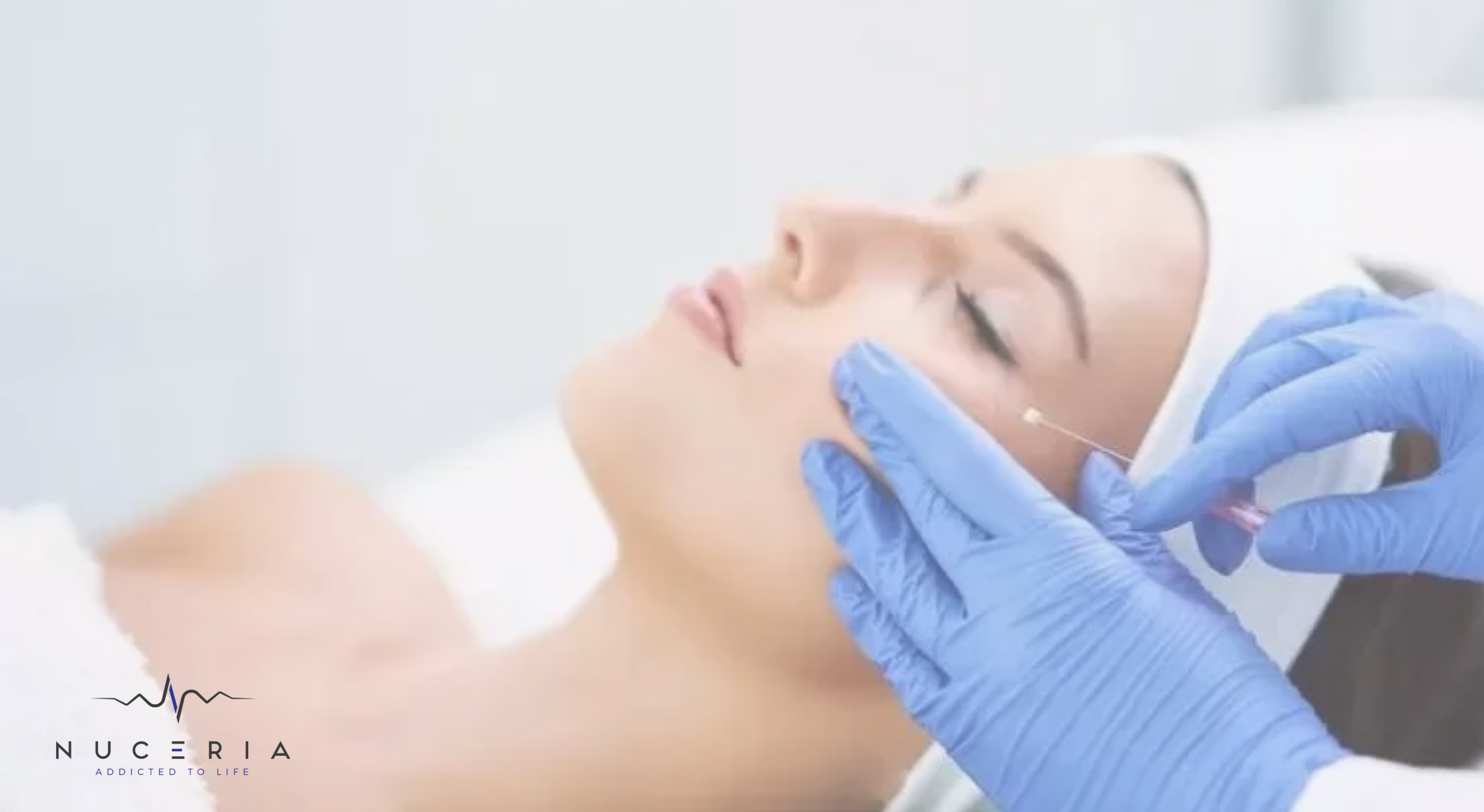 Facial Rejuvenation:  PDO vs Endolift at Nuceria