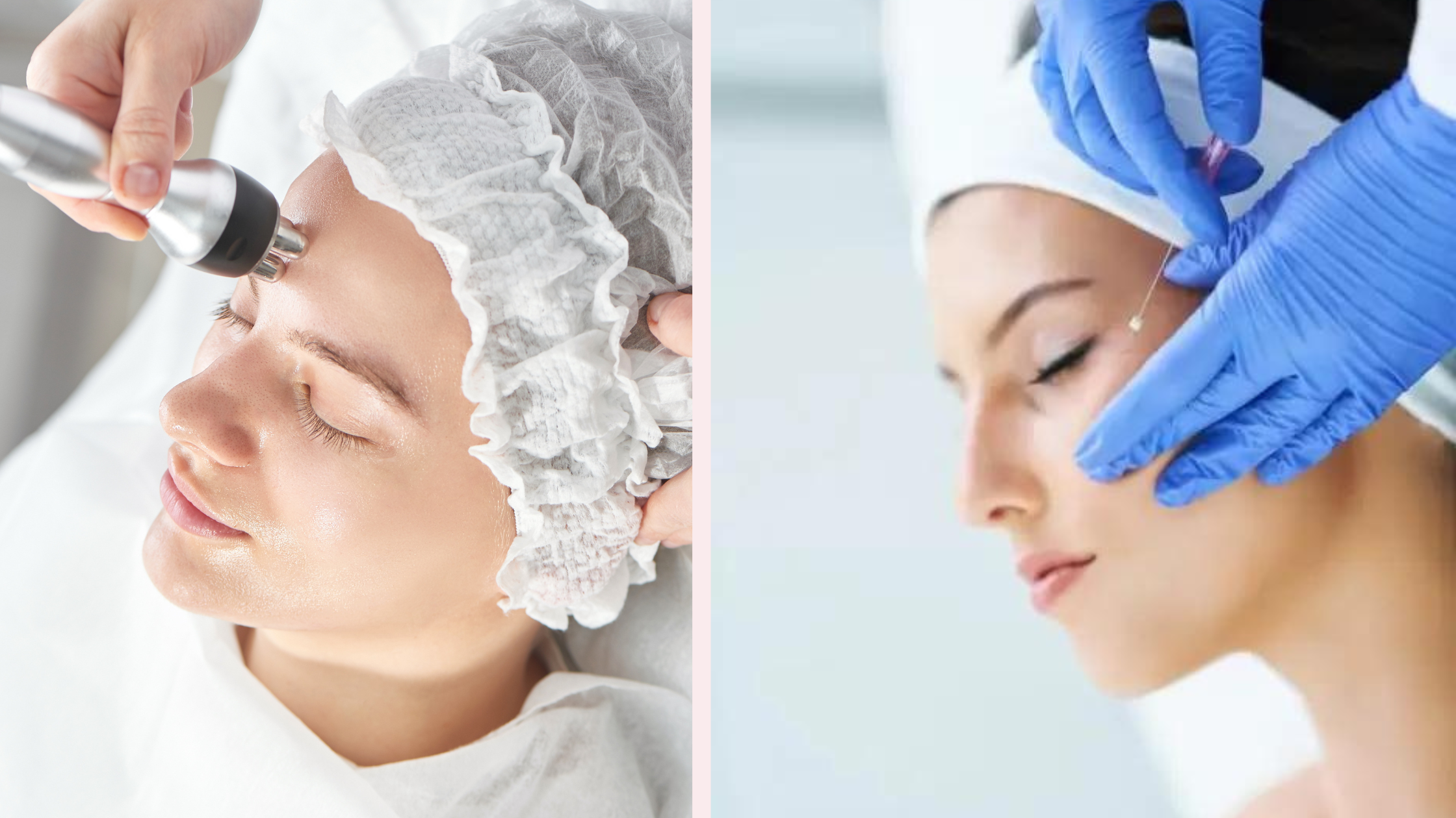 Endolift + Radiofrequency: Skin Tightening Without Surgery