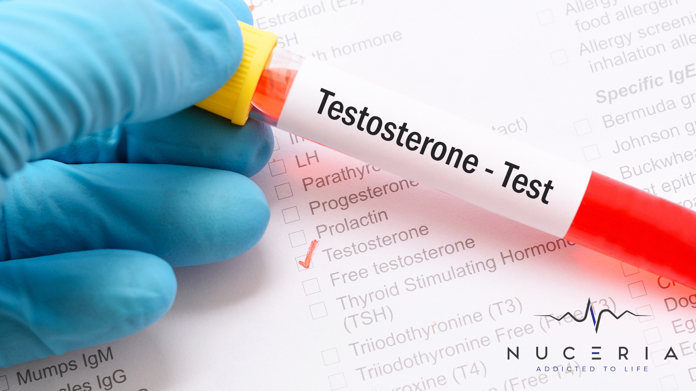 Bioidentical vs Traditional Testosterone — Which Is Better?