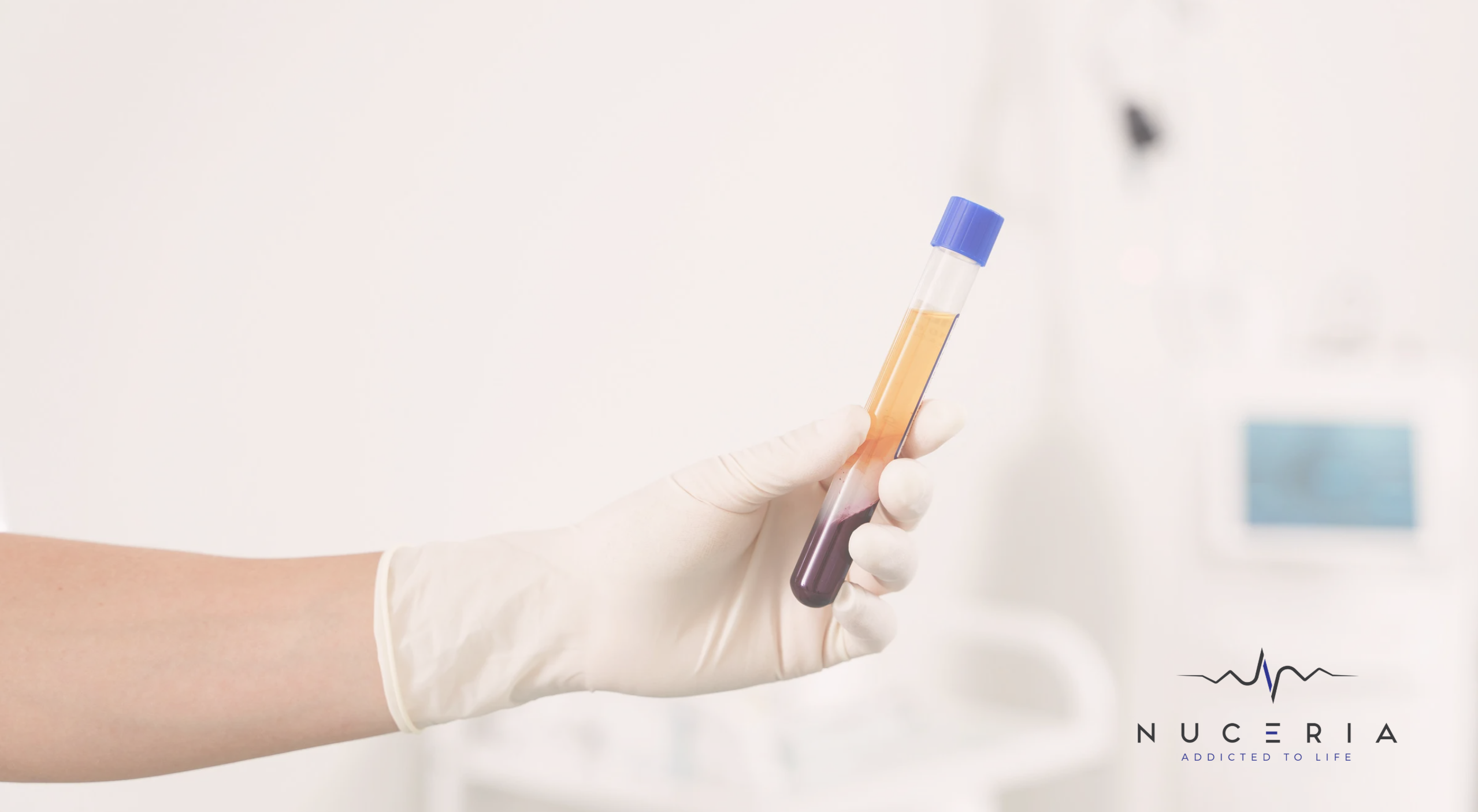 Platelet-Rich Plasma: The Radiance Solution