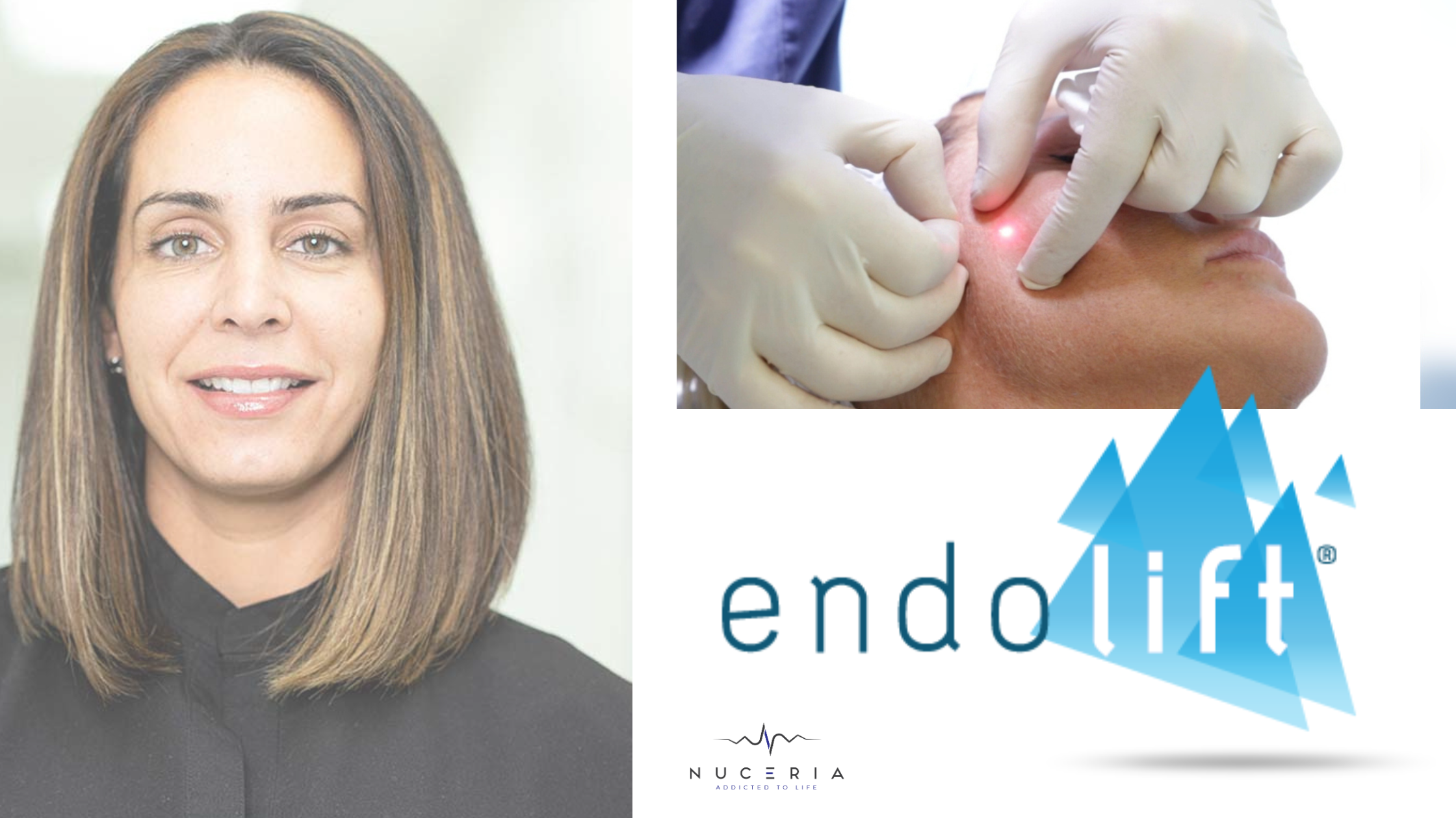 Samantha Fonte, FNP-BC: Endolift Expert & Training, Miami