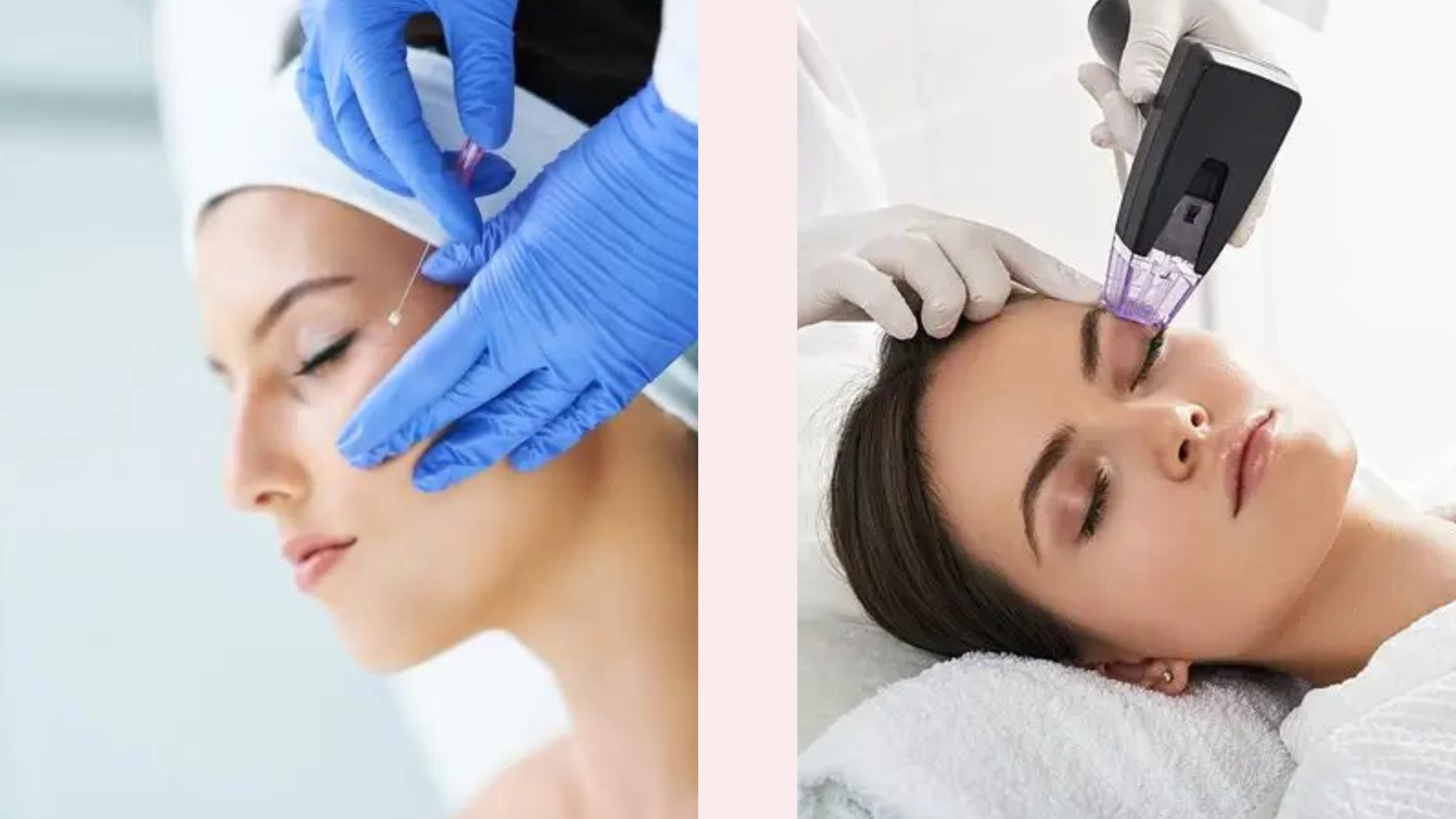 Endolift vs Ultherapy vs Morpheus8 in Miami