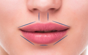 LINING VERMILLION BORDER OF IIPS &  DEFINING CUPIDS BOW