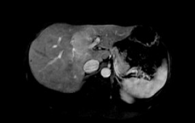 abdomen-scan