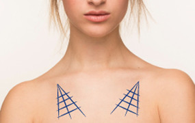 Decolletage Lift