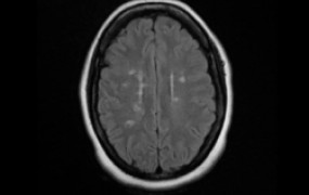 brain-scan