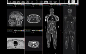 FULL BODY SCAN w/ HEART ECHOCARIOGRAM